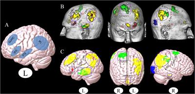 Frontiers | New Perspective For Non-invasive Brain Stimulation Site ...